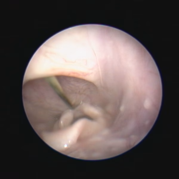Scopy