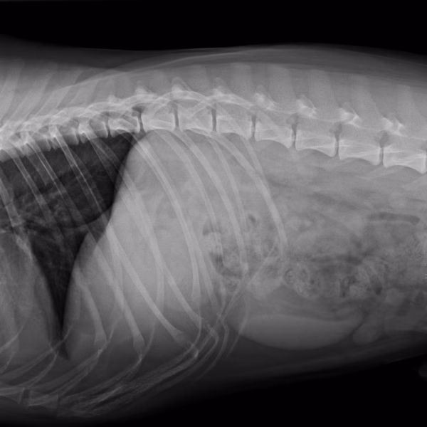 X-ray